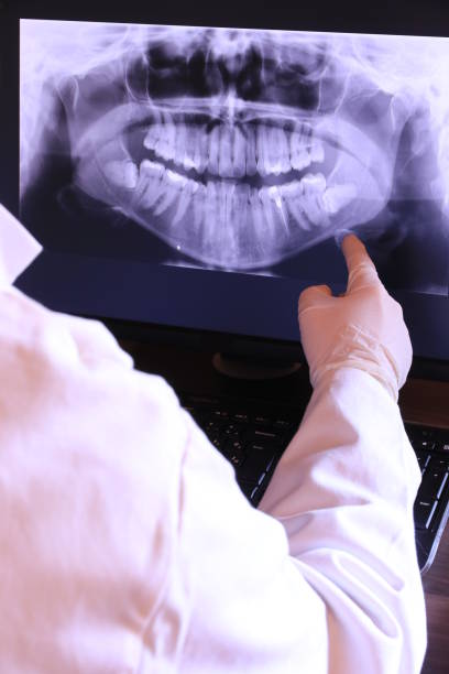 Best Knocked-Out Tooth (Avulsed Tooth) Treatment in Kaufman, TX
