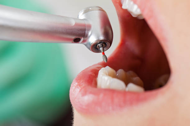 Best Weekend Emergency Dental Services in Kaufman, TX